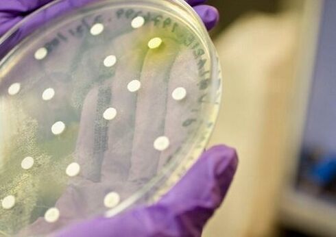 Culture bactérienne pour le diagnostic de la prostatite